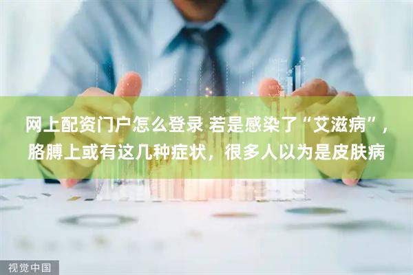 网上配资门户怎么登录 若是感染了“艾滋病”，胳膊上或有这几种症状，很多人以为是皮肤病